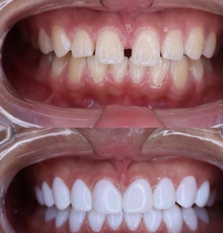 Dentist in Trivandrum – Dr. Kashi Vishwanath